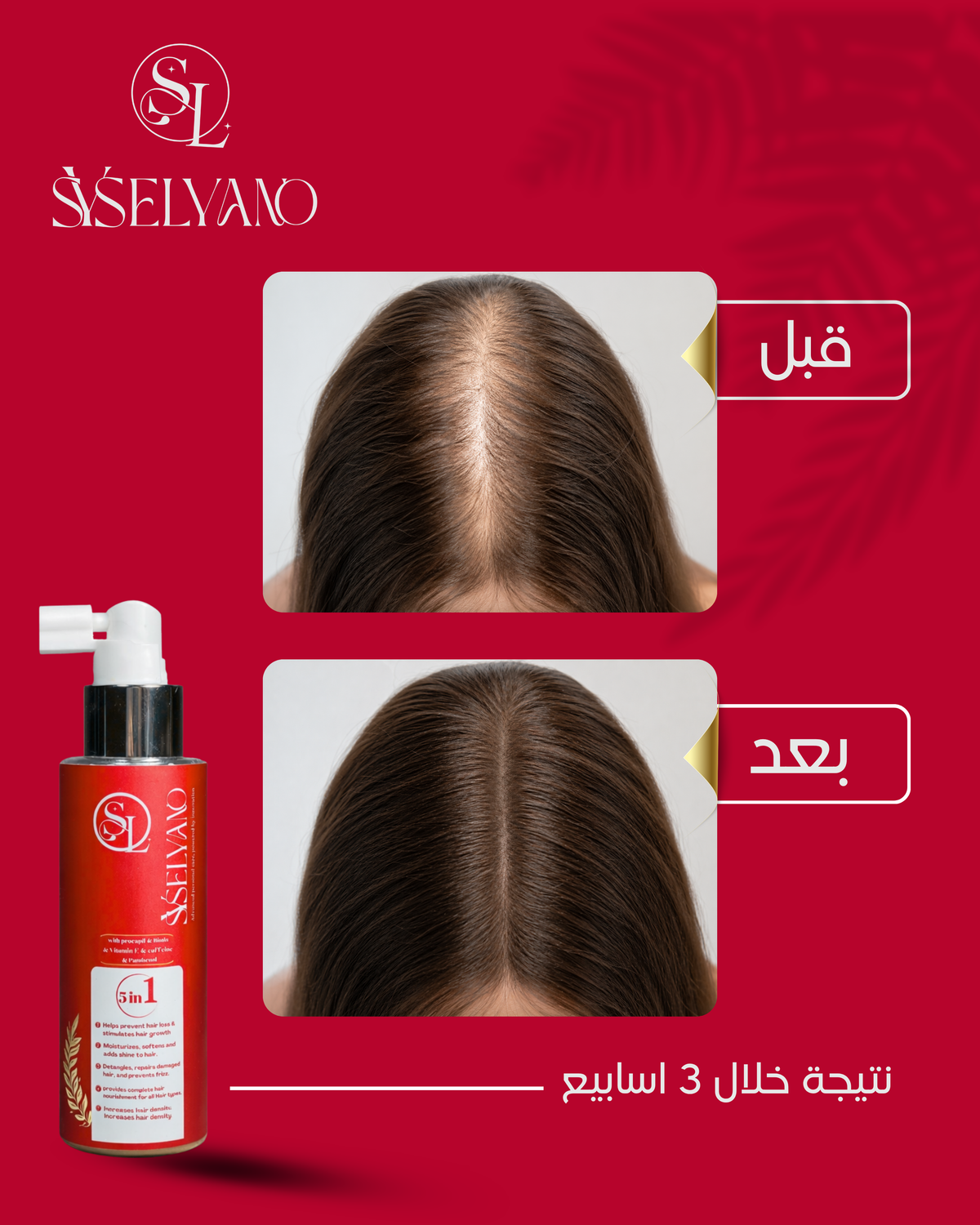 مجموعة العناية بالشعر 5 في 1